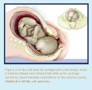The embryo pierces the pelvis in what is medically termed a left occiput anterior (LOA) or left fetal lie position.
