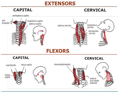Figure 4 : Hypercontracted head/neck extensor muscles and retrusive jaws typically occur in tandem. The Class II is the second most commonly seen neck/jaw dysfunction, preceded only by Class IVs. Clients develop this retrusive jaw/forward-head posture when tight and SHORT capital and cervical extensor muscles overpower all the neck’s flexors (except SCMs). Clients presenting with extensor-dominate necks are easy to spot, as shortened extensors create a cervical-bowing pattern with the apex of the hyperlordotic curve peaking at about C4-5. All structures at the apex of the curve are particularly vulnerable to disc, ligament and facet degeneration.