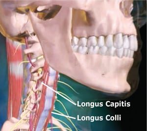Figure 6: Anterior longitudinal ligament. The cervical spine’s ligament is a much thinner and weaker structure than the posterior. When reciprocally weakened, longus capitis muscles allow the SCMS to cock the head and bow the neck, the anterior longitudinal ligament overstretched creating an unstable cervical spine.
