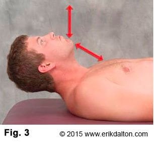 The most commonly seen substitution pattern (SCMs, anterior scalenes, longus colli, and longus capitis) causes the chin to reach toward the ceiling rather than tucking into the chest during the first two inches of flexion efforts (Fig. 3).