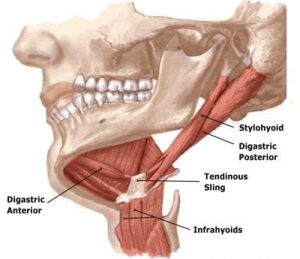 Image 2: Hypertonic jaw openers retrude the mandible.
