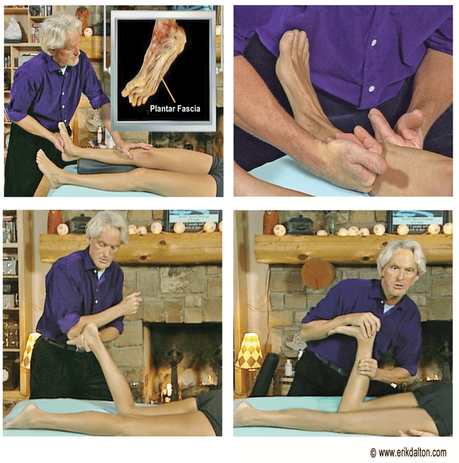 Erik Dalton treats the lower leg to reduce pain caused by high heels.