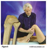 With the knee flexed, my fingers and thumb were unable to budge the fibula in an anterior direction and any attempt to pressure it back into place replicated the intense pain Dr. Smith identified as the source of his problem (Fig. 8).
