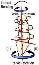 Figure 2. Backward sacral torsion. Courtesy of Erik Dalton.