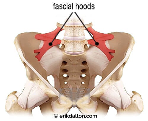 Image 4: Iliolumbar ligaments form fascial hoods that provide lumbosacral and sacroiliac joint stability.
