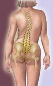 When someone hears the diagnosis “scoliosis” they often think about someone who is hump-backed and deformed, but often that is not the case at all.
