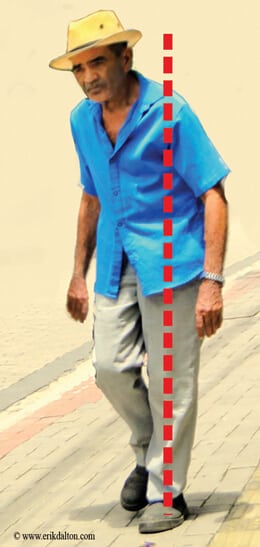 Image 2. Homolateral gait unlevels the eyes, initiates head righting reflexes, and distorts balance.