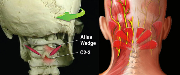 Fig. 3 – OCI controls head on neck rotation