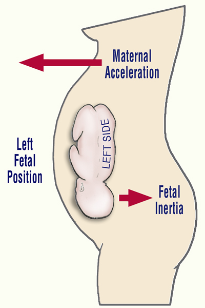 Figure 4: Fetal Intertia. Adapted from Psychological Review by Fred Previc.