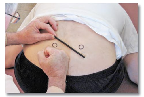 Fig. 14: This photo shows a spring test to left lower sacral quadrant below left oblique axis. The circles overlie the left and right PSIS. The client is in yoga child pose position. The spring/micro-motion test is applied to the left lower quadrant, below the left oblique axis.