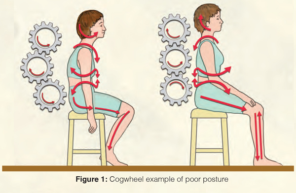Figure 1: Cogwheel example of poor posture