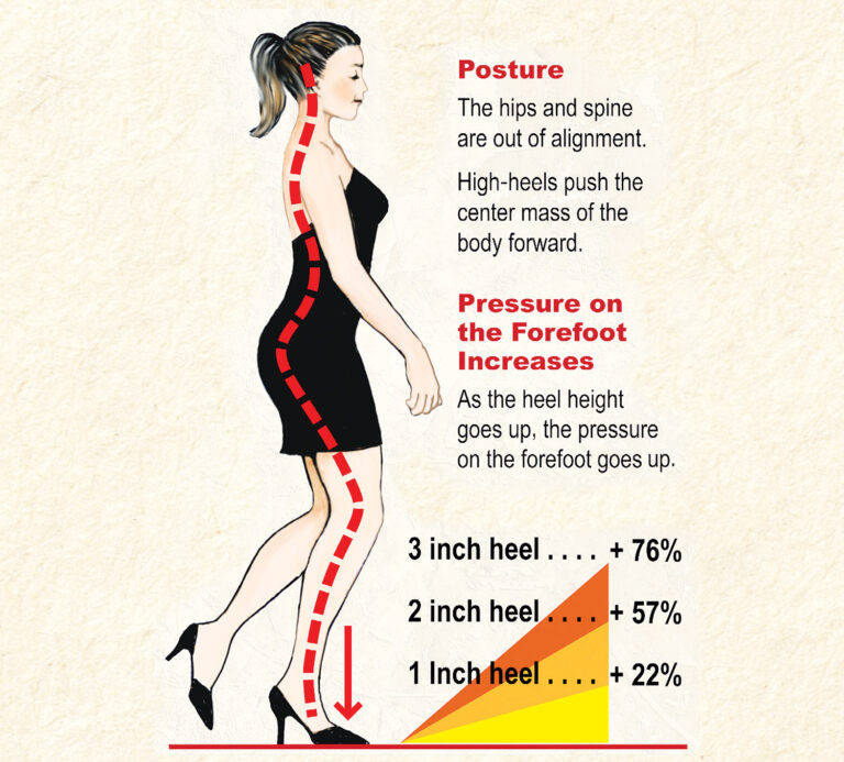 Heel Wedge Angle and Ball-Walking - Erik Dalton Blog