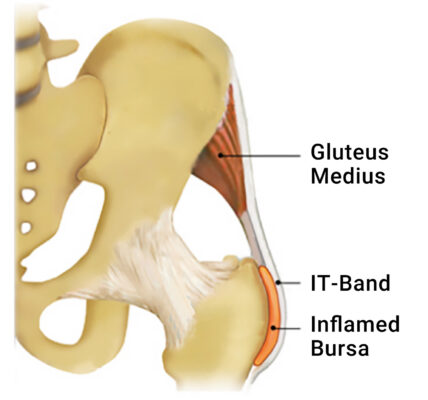 Image1-ITband